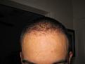 Click image for larger version

Name:	IMG_3060.jpg
Views:	435
Size:	31.2 KB
ID:	433304