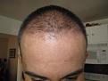 Click image for larger version

Name:	IMG_3076.jpg
Views:	466
Size:	35.5 KB
ID:	433312