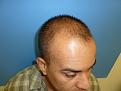Click image for larger version

Name:	before pics3.jpg
Views:	490
Size:	53.4 KB
ID:	433348