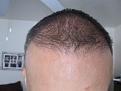 Click image for larger version

Name:	IMG_3395.jpg
Views:	490
Size:	41.4 KB
ID:	433380