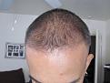 Click image for larger version

Name:	IMG_3397.jpg
Views:	504
Size:	41.8 KB
ID:	433381