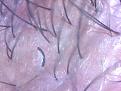 Click image for larger version

Name:	Dead hair.JPG
Views:	2842
Size:	36.7 KB
ID:	433426
