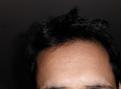 Click image for larger version

Name:	Pre treatment - Front.jpg
Views:	1002
Size:	31.3 KB
ID:	433431