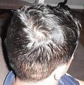 Click image for larger version

Name:	Pre treatment - Back.jpg
Views:	990
Size:	44.3 KB
ID:	433432