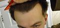 Click image for larger version

Name:	hairline1.jpg
Views:	377
Size:	98.0 KB
ID:	433436