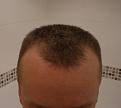 Click image for larger version

Name:	IMGP1880.jpg
Views:	442
Size:	93.1 KB
ID:	433475