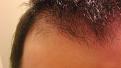 Click image for larger version

Name:	hair.jpg
Views:	1060
Size:	91.1 KB
ID:	433505