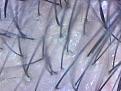 Click image for larger version

Name:	Mid scalp density image.jpg
Views:	379
Size:	13.1 KB
ID:	433525