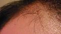 Click image for larger version

Name:	hair.jpg
Views:	451
Size:	87.0 KB
ID:	433533