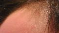 Click image for larger version

Name:	hair.jpg
Views:	607
Size:	84.5 KB
ID:	433556