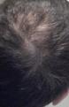 Click image for larger version

Name:	hair2.jpg
Views:	671
Size:	55.6 KB
ID:	433561