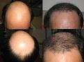 Click image for larger version

Name:	C4 months.jpg
Views:	541
Size:	41.1 KB
ID:	433629