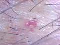 Click image for larger version

Name:	Graft growth at month 6.jpg
Views:	692
Size:	14.7 KB
ID:	433636
