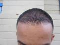 Click image for larger version

Name:	IMG_4223.jpg
Views:	408
Size:	40.1 KB
ID:	433654