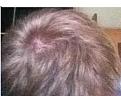 Click image for larger version

Name:	hl333.jpg
Views:	397
Size:	17.1 KB
ID:	433726