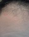 Click image for larger version

Name:	hair.jpg
Views:	564
Size:	47.8 KB
ID:	433777