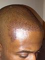 Click image for larger version

Name:	IMG-20120209-00225-crop.jpg
Views:	3797
Size:	41.6 KB
ID:	433808