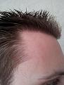 Click image for larger version

Name:	chris hair 3.jpg
Views:	521
Size:	89.1 KB
ID:	433837