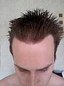 Click image for larger version

Name:	chris hair 5.jpg
Views:	506
Size:	88.4 KB
ID:	433839