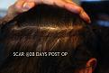 Click image for larger version

Name:	SCAR-28-DAYS-POT-OP.jpg
Views:	397
Size:	65.7 KB
ID:	433841