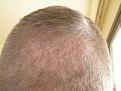 Click image for larger version

Name:	back 4 2 months.jpg
Views:	1483
Size:	84.1 KB
ID:	433848