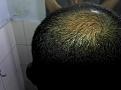 Click image for larger version

Name:	Month 7 - Crown.jpg
Views:	1531
Size:	86.6 KB
ID:	434154