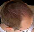 Click image for larger version

Name:	2012-05-15-2062.jpg
Views:	407
Size:	88.8 KB
ID:	434169