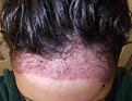 Click image for larger version

Name:	Hair-Front.jpg
Views:	446
Size:	81.0 KB
ID:	434305