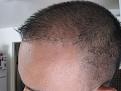 Click image for larger version

Name:	IMG_5155.jpg
Views:	416
Size:	45.7 KB
ID:	434352