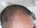Click image for larger version

Name:	little hair temple.jpg
Views:	393
Size:	47.8 KB
ID:	434365