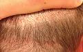 Click image for larger version

Name:	top scar.jpg
Views:	1505
Size:	97.1 KB
ID:	434380