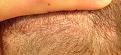 Click image for larger version

Name:	bottom scar.jpg
Views:	1393
Size:	100.4 KB
ID:	434381