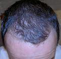 Click image for larger version

Name:	2012-07-02-3071.jpg
Views:	348
Size:	94.8 KB
ID:	434387
