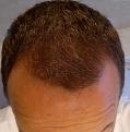Click image for larger version

Name:	2012-07-02-3072.jpg
Views:	352
Size:	58.0 KB
ID:	434388