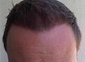 Click image for larger version

Name:	Hairline.jpg
Views:	3626
Size:	91.2 KB
ID:	434414