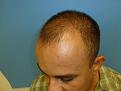 Click image for larger version

Name:	baldy2.JPG
Views:	392
Size:	50.2 KB
ID:	434458