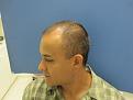 Click image for larger version

Name:	baldy5.jpg
Views:	384
Size:	35.9 KB
ID:	434460