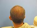 Click image for larger version

Name:	baldy7.jpg
Views:	393
Size:	35.1 KB
ID:	434462