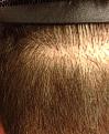 Click image for larger version

Name:	upper scar center 130 days.jpg
Views:	1001
Size:	92.7 KB
ID:	434693
