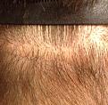 Click image for larger version

Name:	lower scar 130 days.jpg
Views:	1064
Size:	90.8 KB
ID:	434694