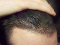 Click image for larger version

Name:	NewHair1.jpg
Views:	1350
Size:	89.4 KB
ID:	434734