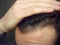 Click image for larger version

Name:	NewHair2.jpg
Views:	1176
Size:	33.8 KB
ID:	434735