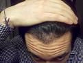 Click image for larger version

Name:	NewHair5.jpg
Views:	1209
Size:	88.1 KB
ID:	434738