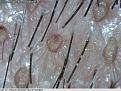 Click image for larger version

Name:	Day-4.5--wound-contraction.jpg
Views:	727
Size:	59.1 KB
ID:	434854