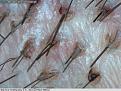 Click image for larger version

Name:	Day-4.5-Strip-Scar-Grafting.jpg
Views:	762
Size:	58.5 KB
ID:	434855
