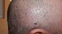 Click image for larger version

Name:	Right-Ear-View-Day-5.jpg
Views:	1706
Size:	97.7 KB
ID:	434857