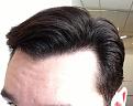Click image for larger version

Name:	Hairline 1.jpg
Views:	1992
Size:	76.8 KB
ID:	434939