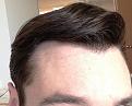 Click image for larger version

Name:	Hairline 2.jpg
Views:	1769
Size:	92.7 KB
ID:	434940