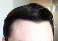 Click image for larger version

Name:	Hairline 3.jpg
Views:	1772
Size:	49.4 KB
ID:	434941