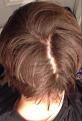 Click image for larger version

Name:	back of head.jpg
Views:	17760
Size:	51.9 KB
ID:	434949